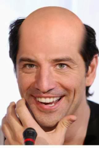 Θαύμα! Οι καραφλοί… βγάζουν μαλλιά!!!