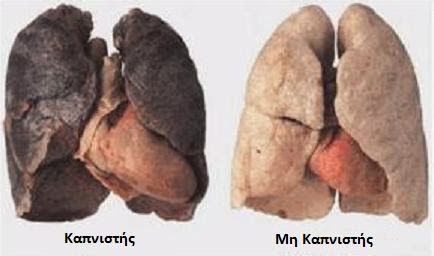 Έτσι είναι οι πνεύμονες των καπνιστών!!! (βίντεο)
