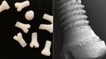 Χειρουργικές βίδες από μετάξι!!! Επανάσταση στην ορθοπεδική…