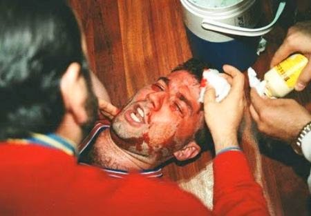 Μαύρη επέτειος σήμερα από την τραυματισμό του αείμνηστου «Μπόμπαν»… (video)