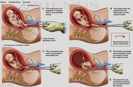 ΣΥΓΚΛΟΝΙΣΤΙΚΟ!!! Το παιδί που σκοτώνεται, δεν ξαναγίνεται το ίδιο ποτέ...