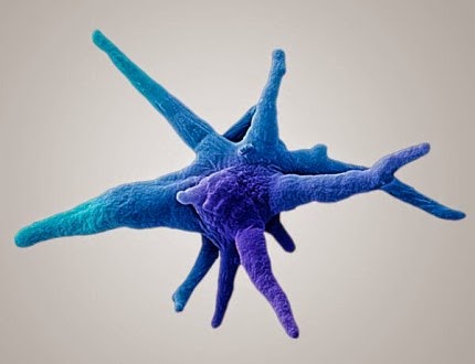 ΣΟΚ! Επικίνδυνος «ιός» απειλεί την Ελλάδα!!! (foto)