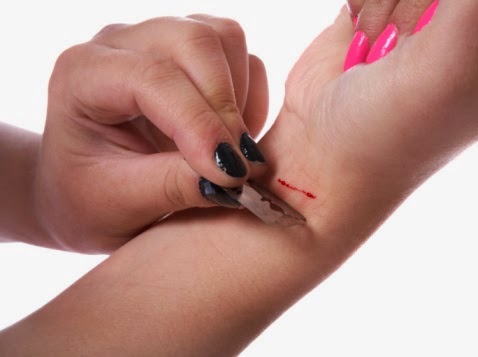 Ελλάδα: Έφηβοι «χαρακώνονται» για να ξεσπάσουν συναισθηματικά!