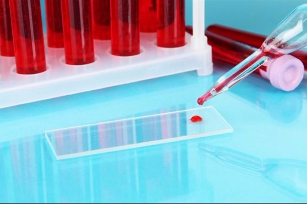 Ανακάλυψη-σταθμός: Εξέταση εντοπίζει τον καρκίνο πριν εμφανιστούν συμπτώματα…