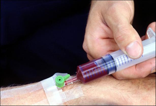 Νέο τεστ αίματος εντοπίζει τον καρκίνο αλλά και το σημείο που αναπτύσσεται...