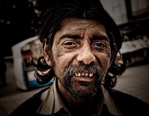 Ο γύφτος στον… οδοντίατρο!!!  (ανέκδοτο)