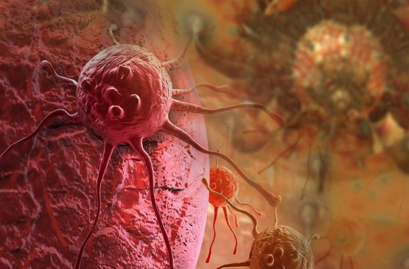 Η πραγματική αιτία όλων των καρκίνων…