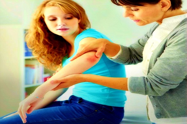 Το άγχος προκαλεί ψωρίαση;