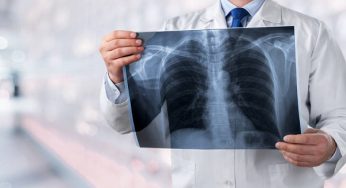 Κάπνισμα: 6 τροφές που βοηθούν να καθαρίσετε τους πνεύμονες από τη νικοτίνη